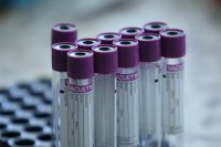 966 са новите потвърдени случаи на коронавирус