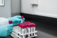 Над 150 единици за антитела по стандарт на СЗО е условието за сертификат
