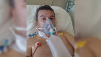 45-годишен неваксиниран мъж оцеля след 30 дни в COVID реанимацията на болница "Лозенец"