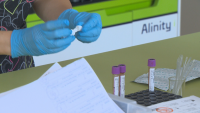 Все още се чакат резултатите от пробите от детето, лекувано от непознат хепатит в Бургас