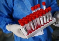 60 са новите случаи на коронавирус у нас за последното денонощие