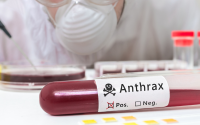 No Human Anthrax Cases Reported in Bulgaria So Far, Authorities Say