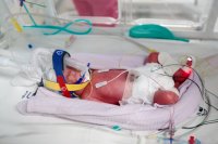 Чудо! Еднояйчни четиризначки се родиха в Австралия